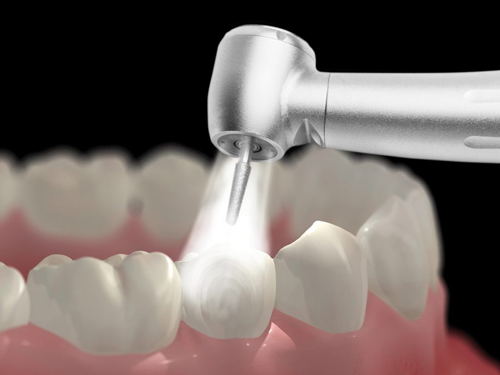Restoratif ve Endodontik Tedavi